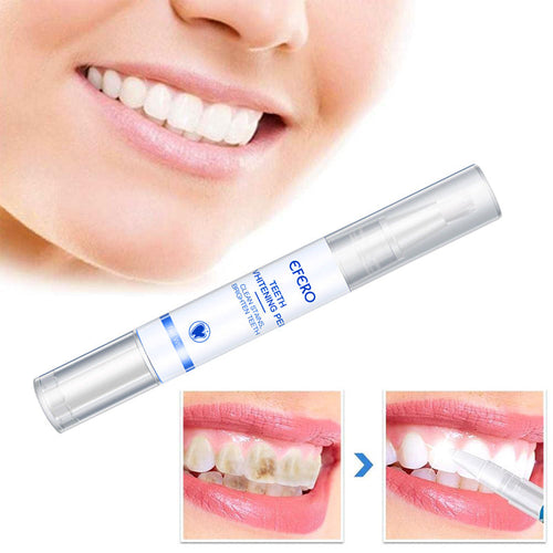 Penna Sbiancante per Denti | Siero Igiene Orale Rimuovi Macchie e Placca