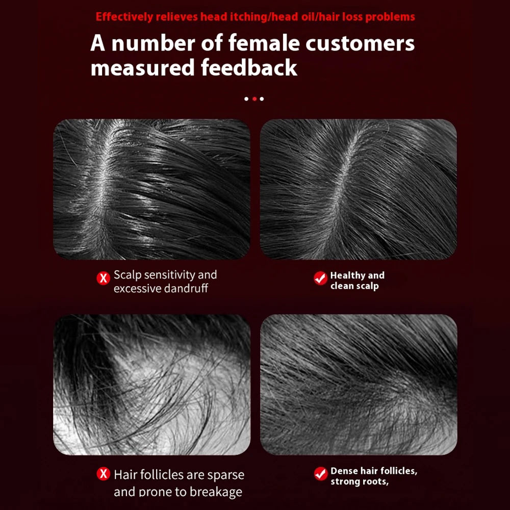 Electric Vibration Massage Comb Massage Scalp Brush Applicator Inject Essential Oils Scalp Care & Hair Care