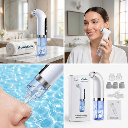 Aspiratore per punti neri, pulitore per pori, aspiratore per punti neri migliorato, aspiratore per il viso ricaricabile, strumento per l'estrazione di comedoni e punti neri